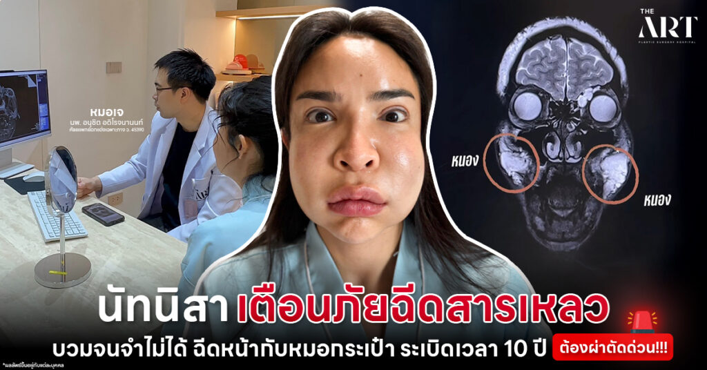 กรณีตัวอย่างอันตรายจากการฉีดสารเหลวโดยหมอกระเป๋า ภาวะแทรกซ้อนร้ายแรงที่อาจเกิดขึ้นได้ ที่ The Art Hospital