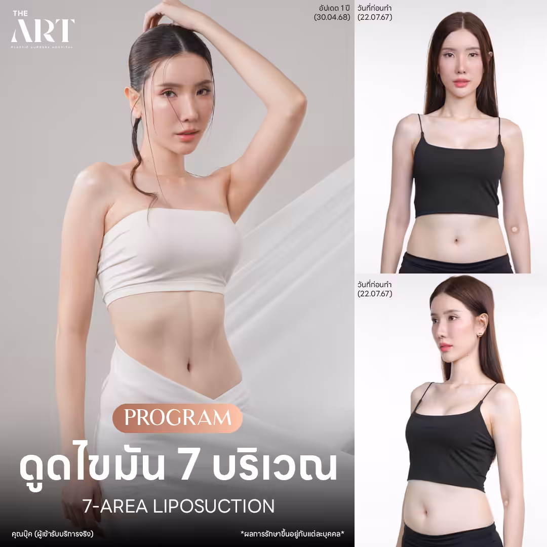 liposuction-7-areas-fashion-set-khun-book.png