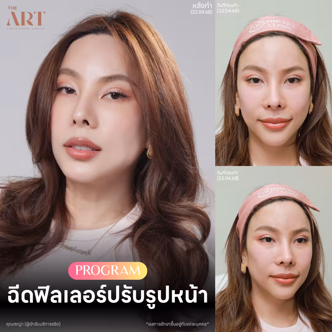 facial-contouring-filler-fashion-set-khun-seya.jpg
