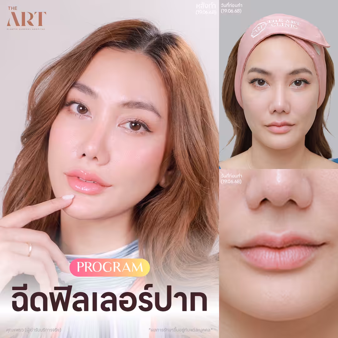 lip-filler-fashion-set-khun-praew.jpg
