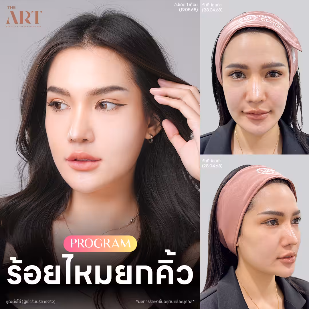 thread-lift-fashion-set-khun-tang-oh-1.jpg
