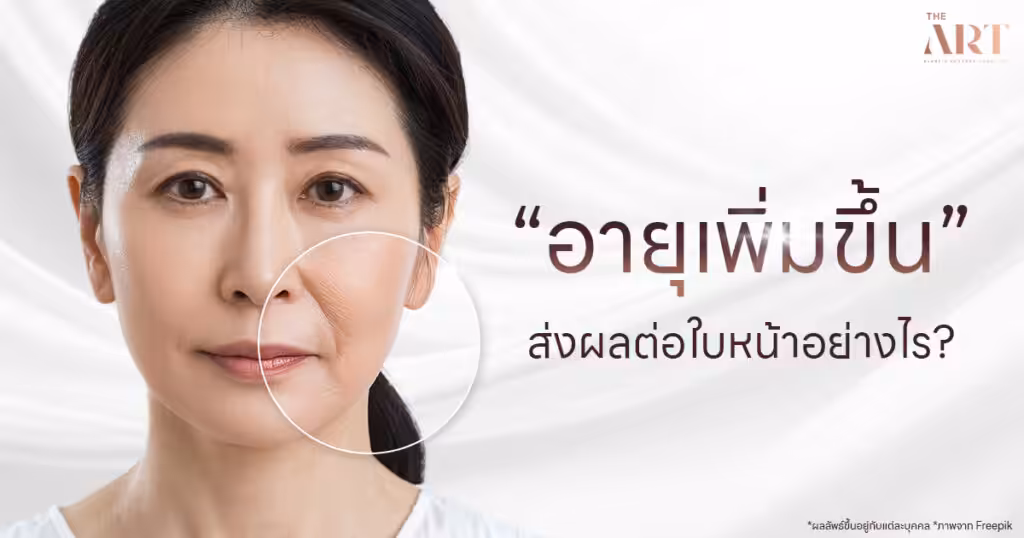 อายุเพิ่มขึ้นส่งผลต่อผิวหน้าและความหย่อนคล้อย