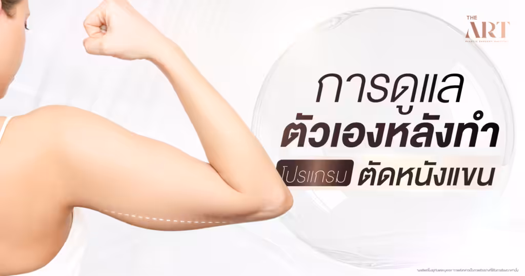 การดูแลหลังตัดหนังแขน