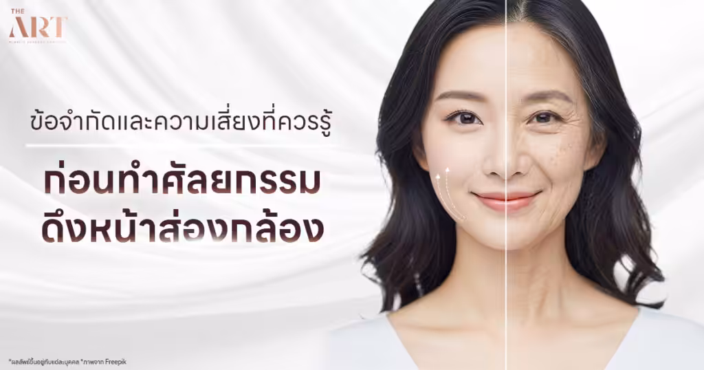 What to know before endoscopic facelift surgery