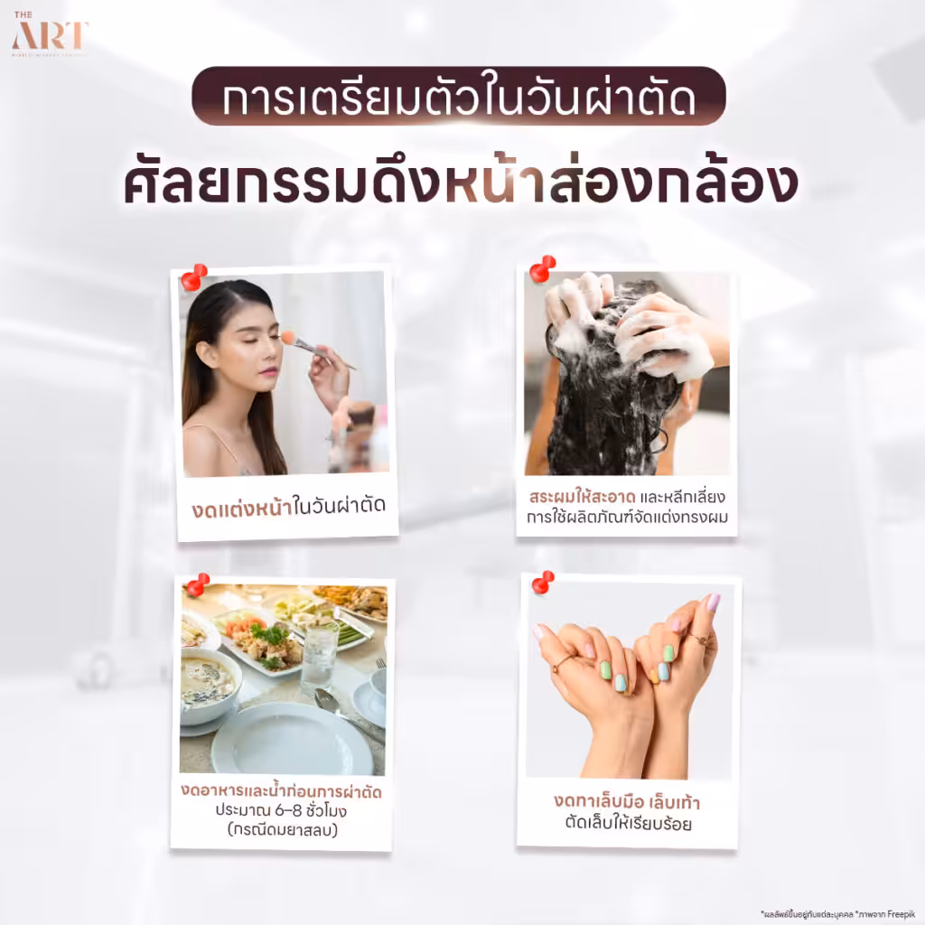 การเตรียมตัวในวันผ่าตัดดึงหน้าส่องกล้อง