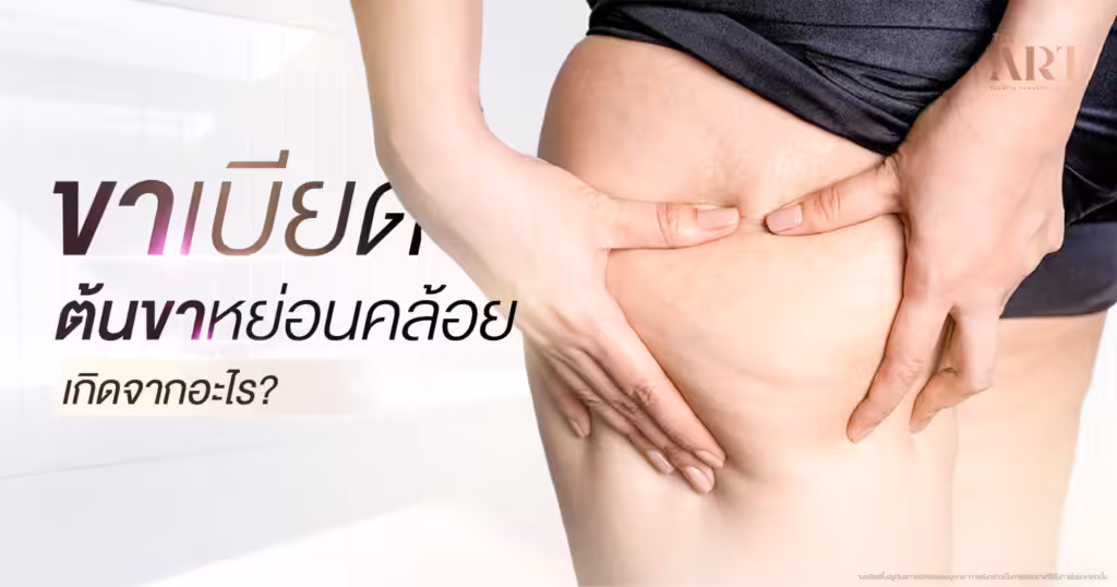 ขาเบียด ต้นขาหย่อนคล้อย เกิดจากอะไร