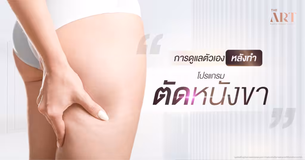 การดูแลตัวเองหลังตัดหนังขา