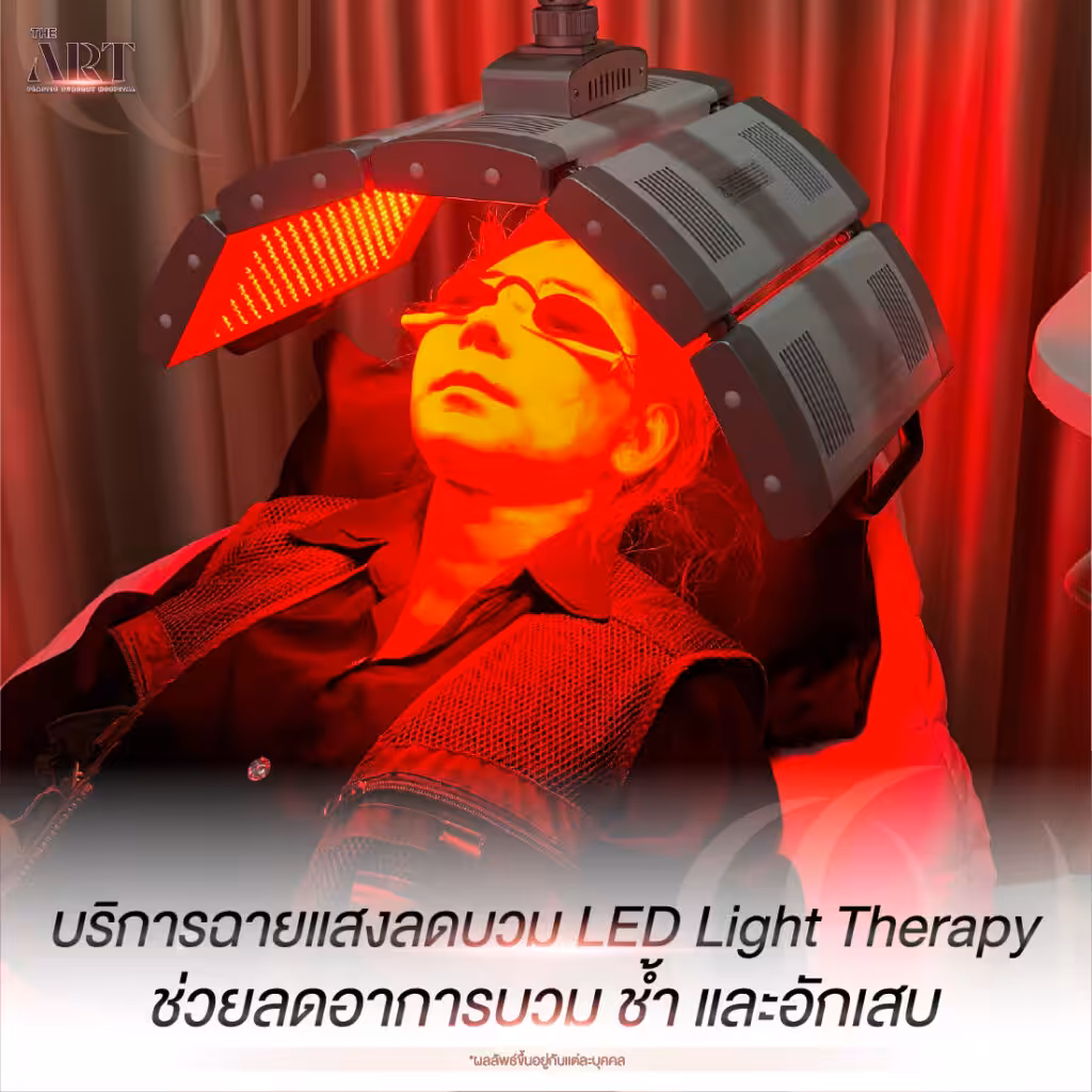 ฉายแสง LED Light Therapy ช่วยลดอาการบวม