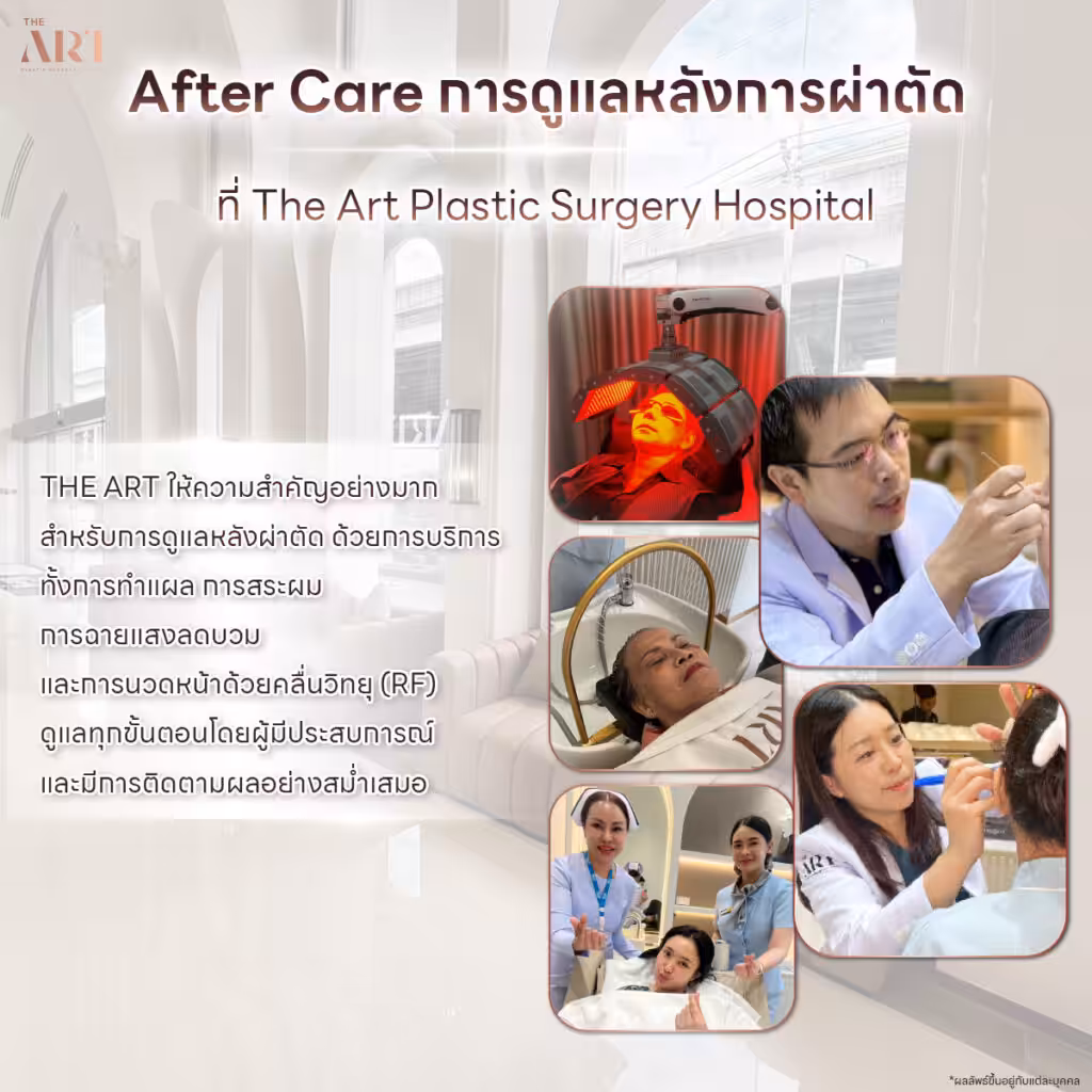 After Care หลังผ่าตัดดึงหน้า