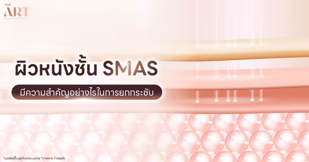 ยกกระชับใบหน้า ชั้น SMAS