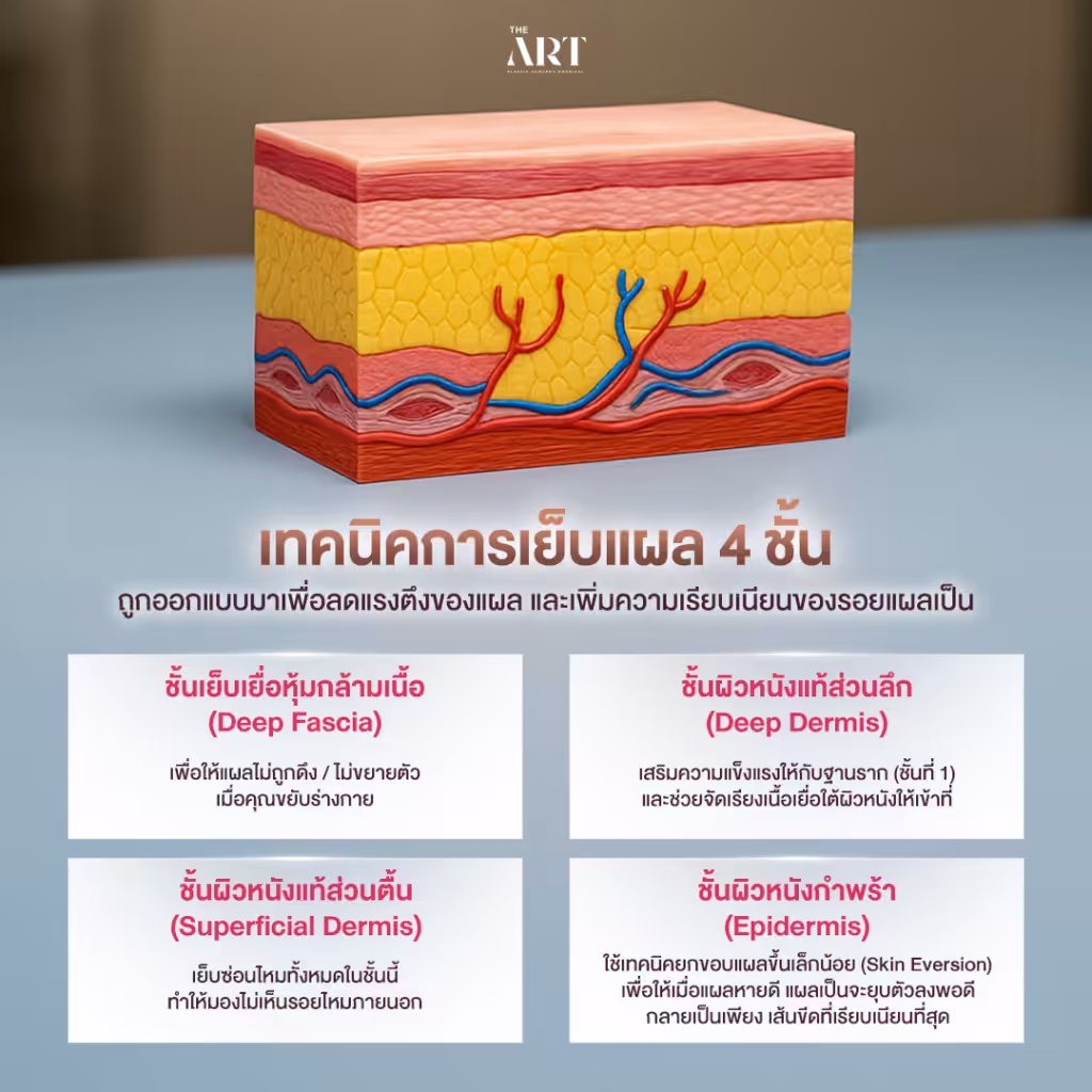 เทคนิคเย็บแผล 4 ชั้น The Art Hospital
